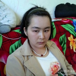 失踪人员：蒋官辉 女 32岁 精神病障碍患者